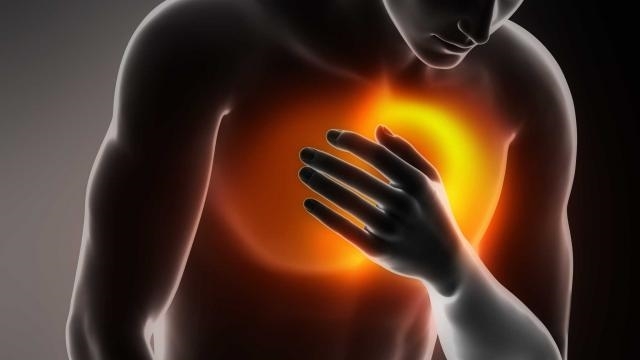 Göğüs ağrısının 5 önemli nedeni! (Her göğüs ağrısı kalp krizini düşündür galerisi resim 10