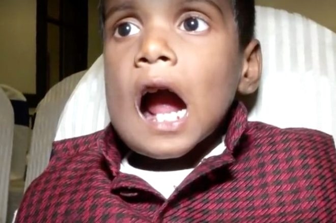 7 yaşındaki çocuğun ağzından 526 diş çıktı! galerisi resim 6