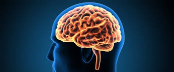 Beyin tümörünün belirtileri nelerdir? galerisi resim 3