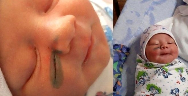 Akılalmaz hata! Doktorlar doğum sırasında bebeğin yüzünü kesti galerisi resim 5