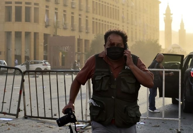 Beyrut'u kana bulayan patlama 300 bin insanı evsiz bıraktı galerisi resim 4
