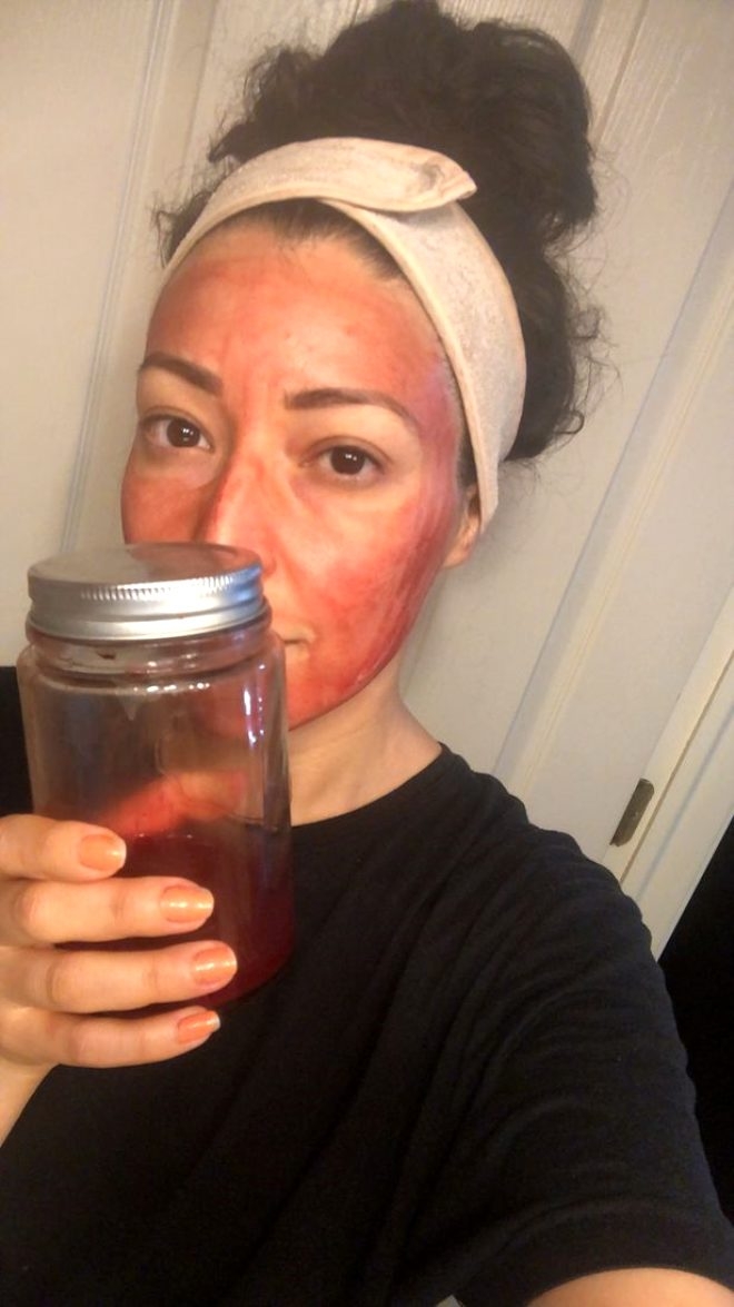 36 yaşındaki kadın, güzelleşmek için regl kanını yüzüne sürüyor galerisi resim 2