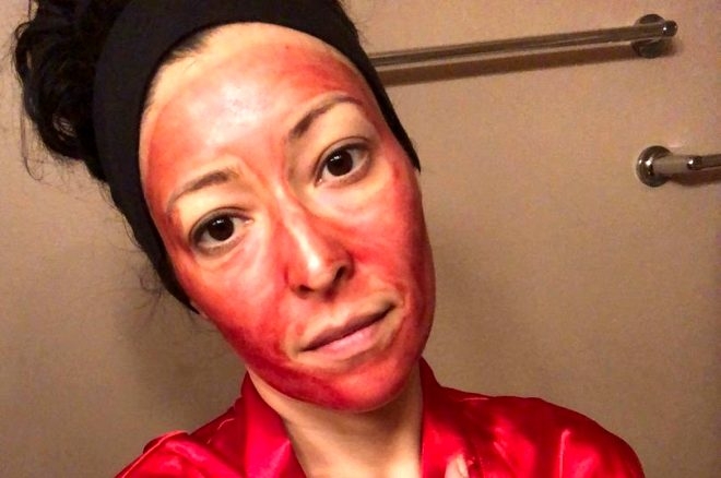 36 yaşındaki kadın, güzelleşmek için regl kanını yüzüne sürüyor galerisi resim 3