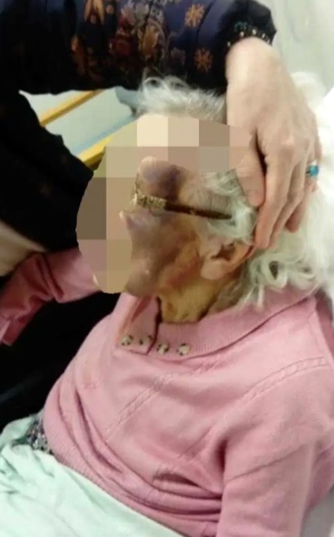 Görüntüler korkunç! 90 yaşındaki kadın, huzurevi çalışanı tarafından tec galerisi resim 3