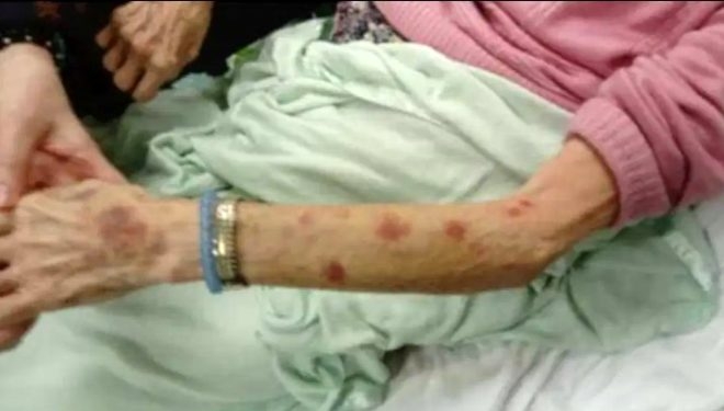 Görüntüler korkunç! 90 yaşındaki kadın, huzurevi çalışanı tarafından tec galerisi resim 4