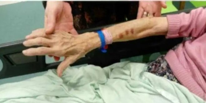 Görüntüler korkunç! 90 yaşındaki kadın, huzurevi çalışanı tarafından tec galerisi resim 7