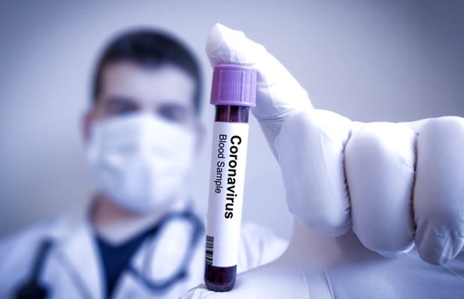 Son araştırma erkekleri derinden üzecek! Koronavirüsün testislerde uzun  galerisi resim 2