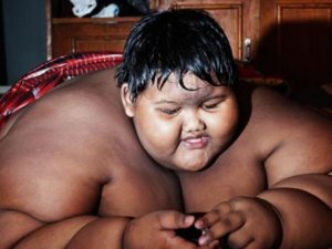 Dünyanın en şişman çocuğu 110 kilo verdi