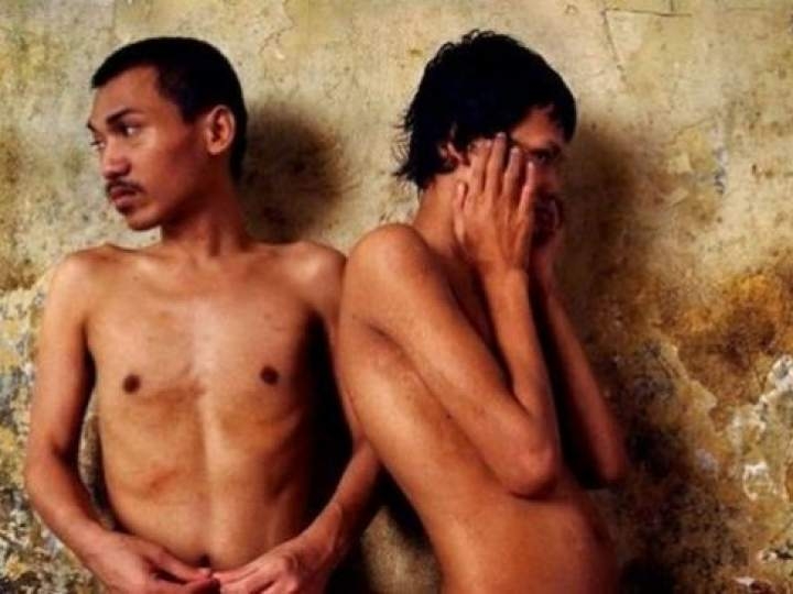 Endonezya'da insanlıktan utandıran görüntüler! galerisi resim 23