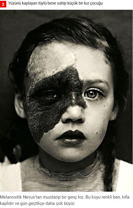 19.yüzyıldan'dan arşivdeki hastalık fotoğrafları galerisi resim 2