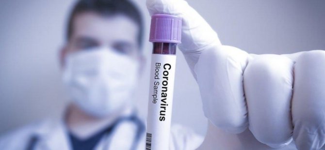 İstanbul Tıp Fakültesi'nde antikor testlerine başlandı: 'Yalancı negatif' sonuçların önüne geçilecek©