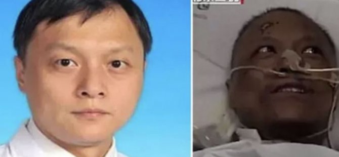 Koronavirüs nedeniyle ten rengi değişen Çinli doktor hayatını kaybetti