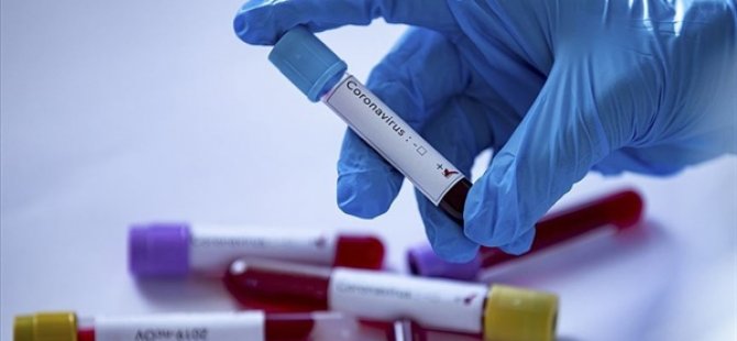 Koronavirüs Testinde Kriterler Değişiyor