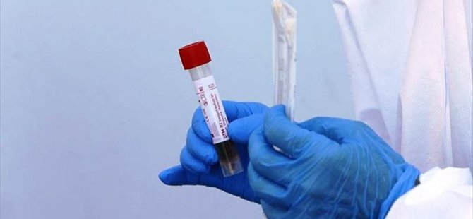 Güney Kıbrıs’ta 4 yeni Koronavirüs vakası tespit edildi