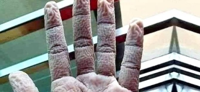 Çapa'da görevli doktorun elinin görüntüsü sosyal medyada gündem oldu