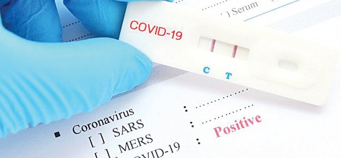 Öğrenci taşıyacak otobüs şoförlerine yönelik ücretsiz PCR testi yapılmaya başlandı