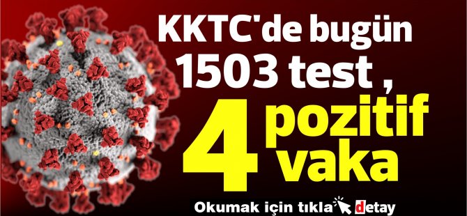 KKTC'de bugün 1503 test , 4 pozitif vaka