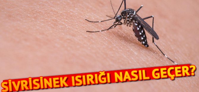 Sivrisinek ısırığına ne iyi gelir? Sivrisinek ısırığı nasıl geçer?