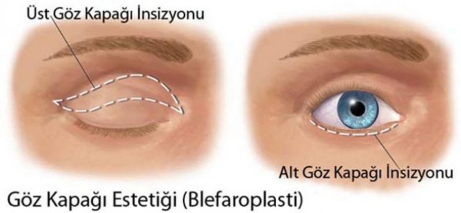 Op.Dr.Diren Çelik; Göz Kapak Problemlerine Dikkat Çekti