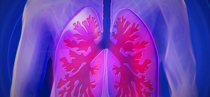 Akciğer Kanserinde Erken Teşhis Başarı Şansını Artırıyor