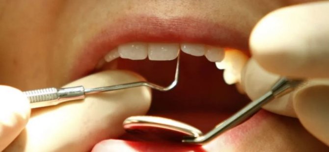 Koronanın yeni belirtisi: Ani diş kaybı