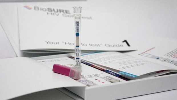 Evde HIV Testi
