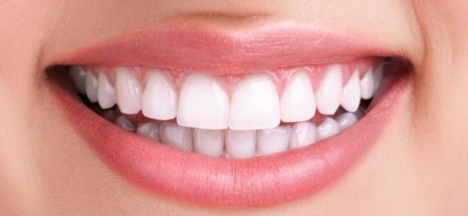 Δρ.  Efe Kaya;  Μπορείτε να έχετε πιο άσπρα δόντια!