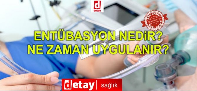 Τι σημαίνει το intubate;  Ποιος είναι το Intubated;