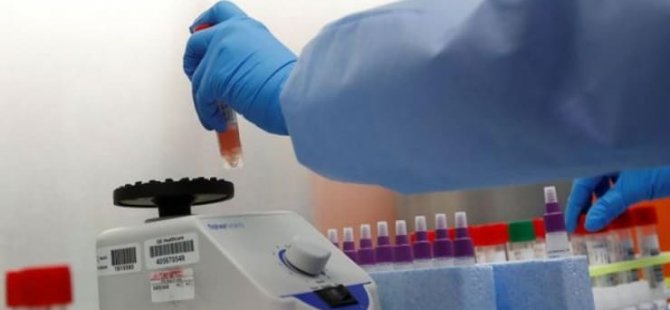 İskele'de bugün itibari ile koronavirüs tespiti hızlı test (antijen) kiti ile yapılacak