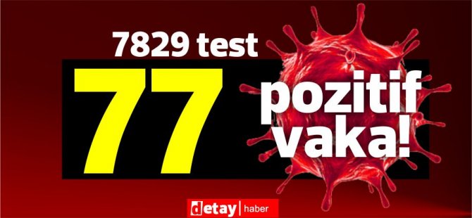 7829  test yapıldı, 58'i yerel 77 pozitif vaka