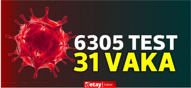 6305 test yapıldı, 19'u yerel 31 pozitif vaka