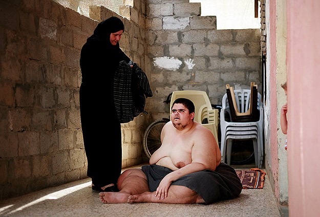 Filistinli obez genç yardım bekliyor