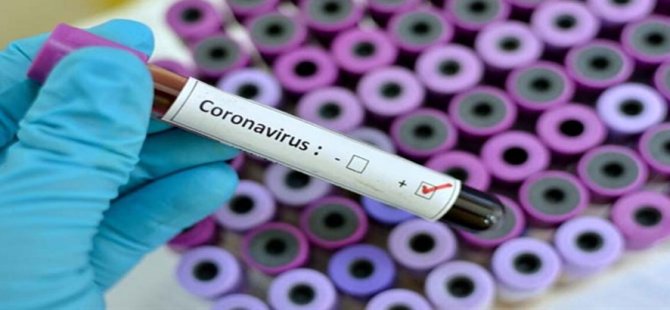 Güney Kıbrıs’ta 19 yaşındaki genç koronavirüs nedeniyle yaşamını yitirdi