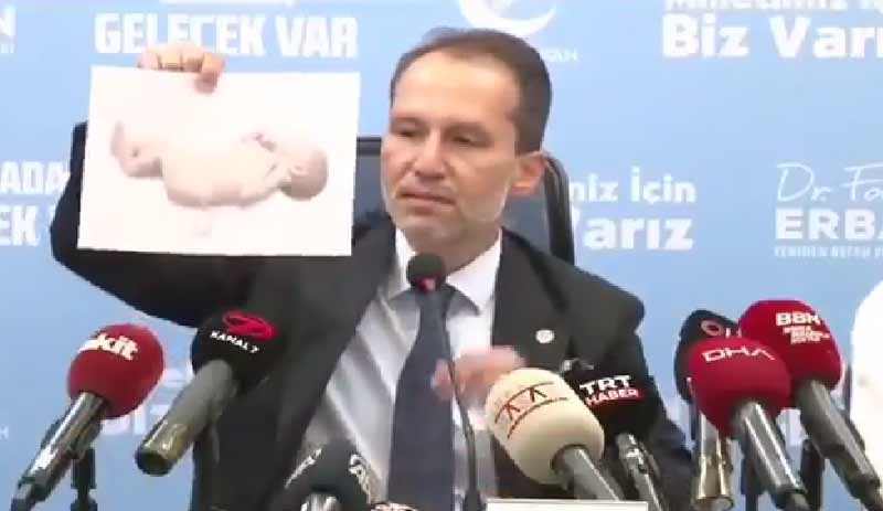 Fatih Erbakan, düzenlediği basın toplantısında 'kuyruklu bebek' fotoğrafları gösterdi