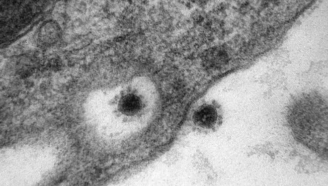 Rusya'da corona virüsün Delta Plus mutasyonu görüntülendi