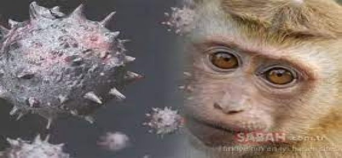 Maymun çiçeği virüsüne karşı önleminizi alın