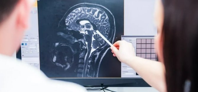 Bilimsel araştırma: Genç yaşta beyin sarsıntısı ileri yaşta demansa yol açabilir