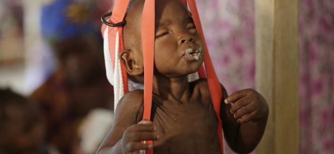 UNICEF: 75 binin üzerinde çocuk açlıktan ölebilir