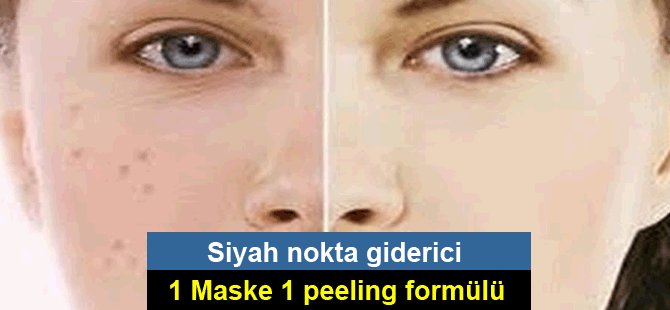 Siyah noktalara karşı etkili 1 maske 1 peeling