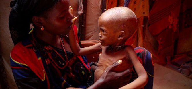 Somali'deki kuraklık ve kolera salgını
