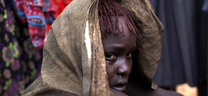 Kadın sünneti Afrika'da azalıyor Ortadoğu'da artıyor