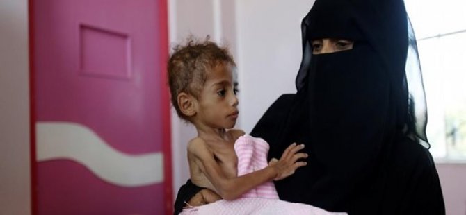 Yemen'de nüfusun yüzde 70'i açlıkla savaşıyor
