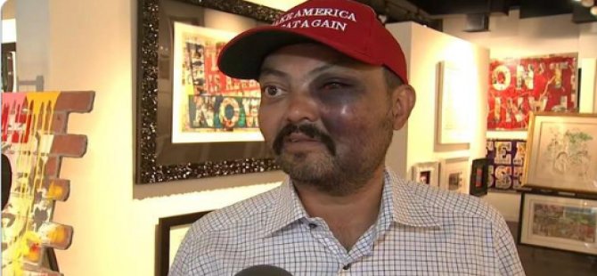 ABD'de bir Türk, Trump destekçisi olduğu için dövüldü