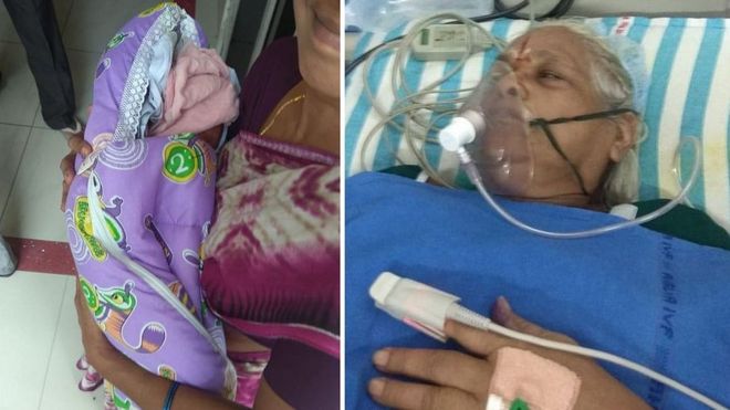 73 yaşındaki kadın ikiz doğurdu, 82 yaşındaki baba ertesi gün inme geçirdi