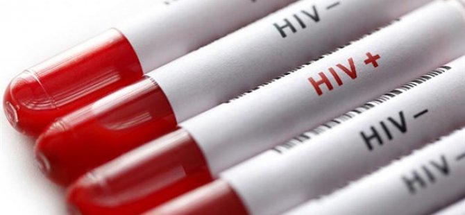 Türkiye'de HIV yayılıyor