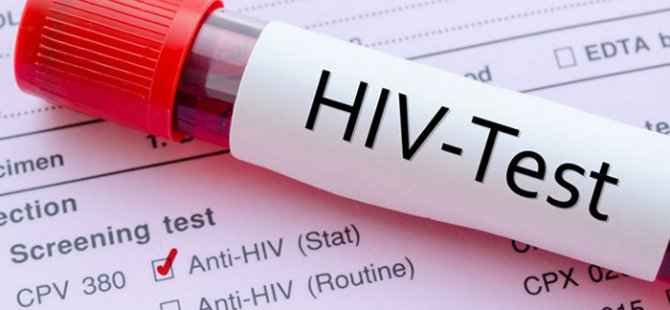 26 bin kişi HIV pozitif