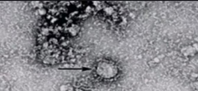 Çin'deki virüsün mikroskopla çekilen görüntüsü yayınlandı