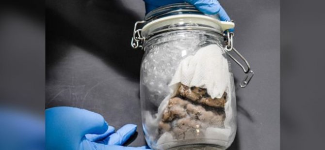 ABD-Kanada sınırında, bir kargo aracından kavanoz içinde insan beyni çıktı