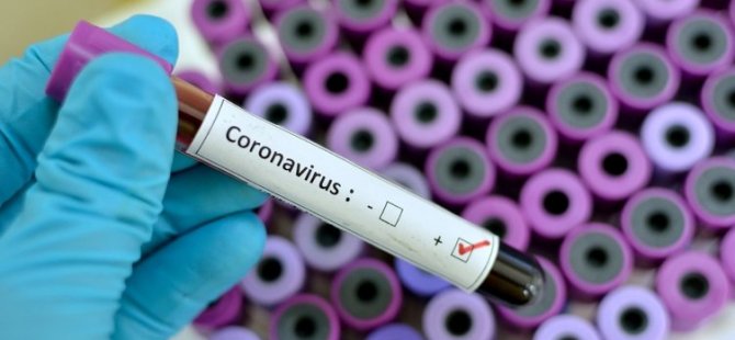 Erkekler koronavirüsten daha çok etkileniyor