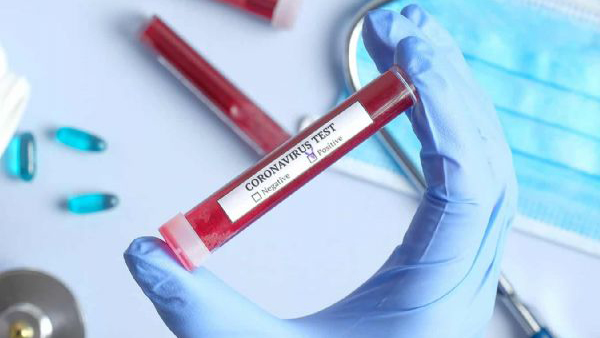 İspanya'da koronavirüs nedeniyle son 24 saatte 832 kişi yaşamını yitirdi